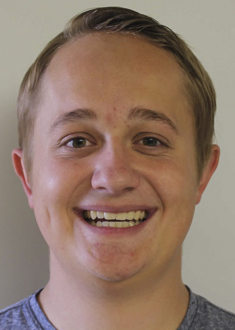 Mason Allgood
